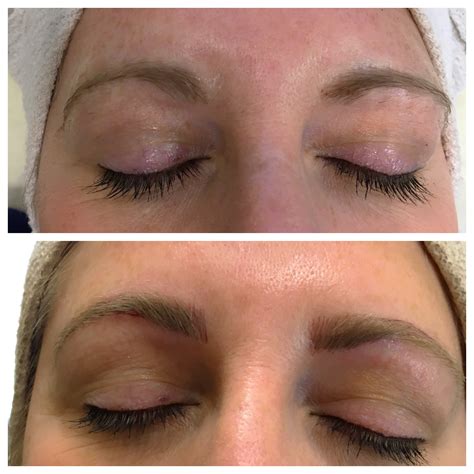 st louis cosmetic surgery spa|Microblading for St. Louis – St. Louis Cosmetic Surgery Inc.